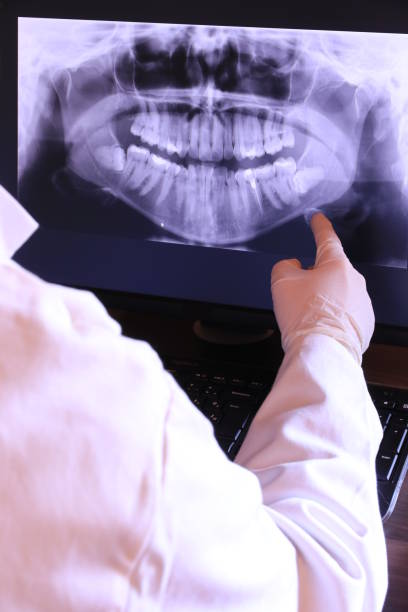 Best Emergency Treatment for Dental Infections or Abscesses in Detroit Beach, MI