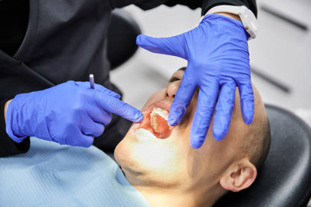 Best Emergency Dental Care for Broken or Chipped Teeth in Detroit Beach, MI